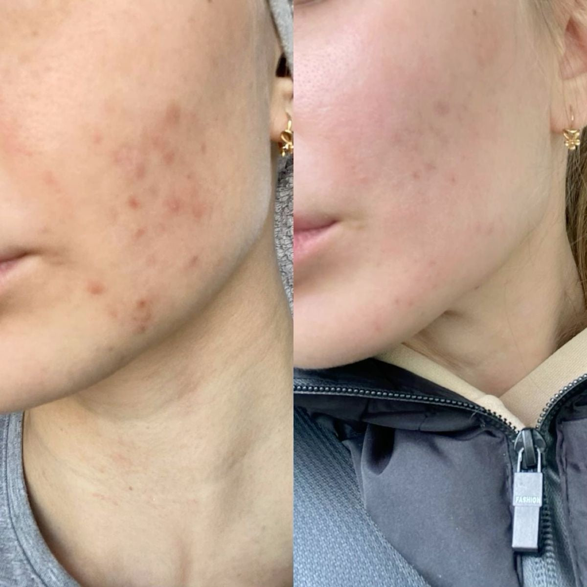 Santorini Sea Salt Serum